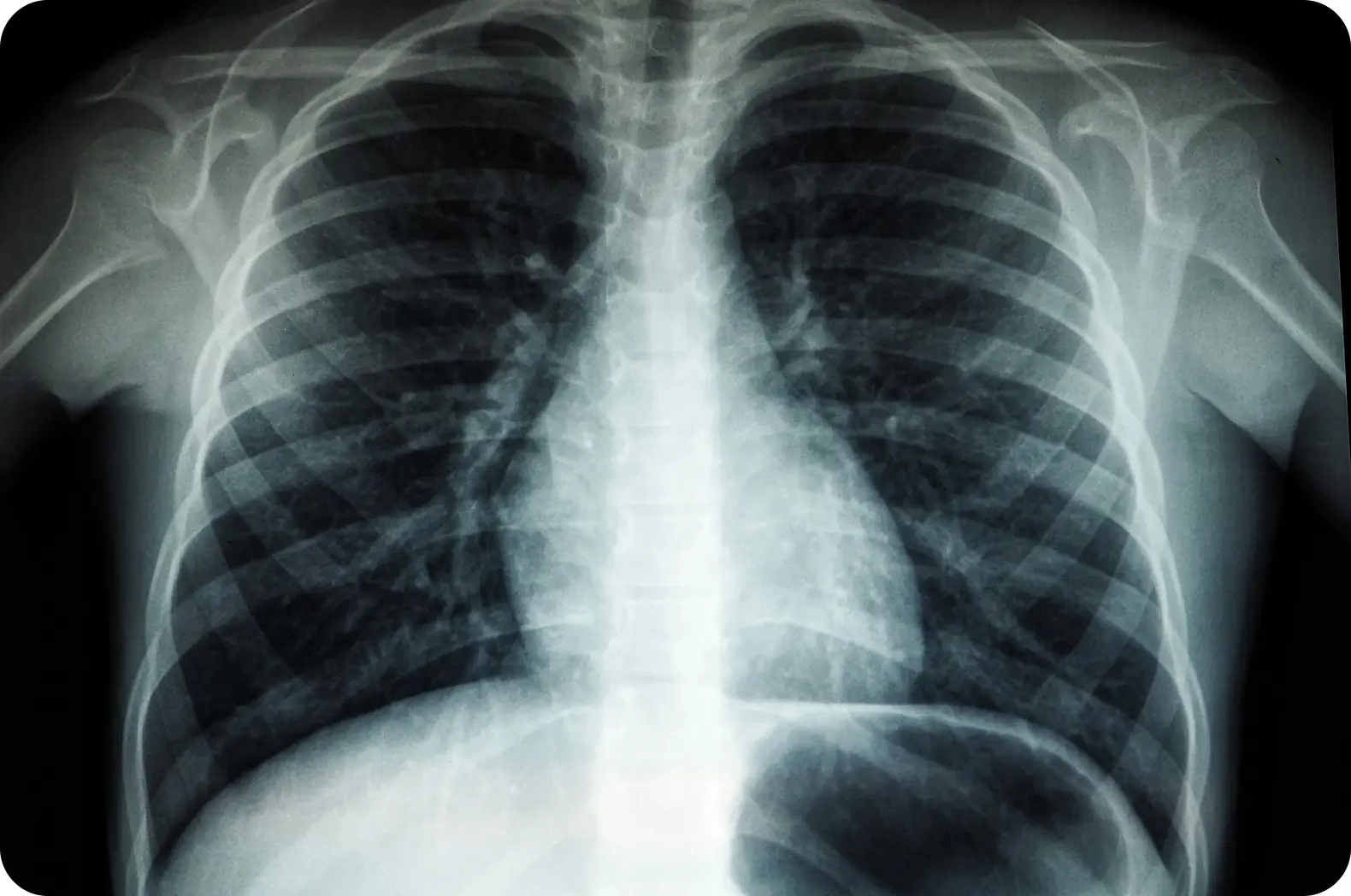 X-RAY AI